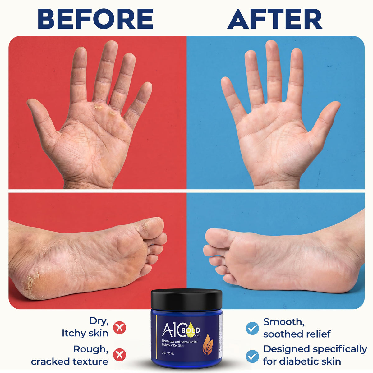 A1C Bold Skincare Diabetic Care Balm beeswax-detail highlights natural barrier support.