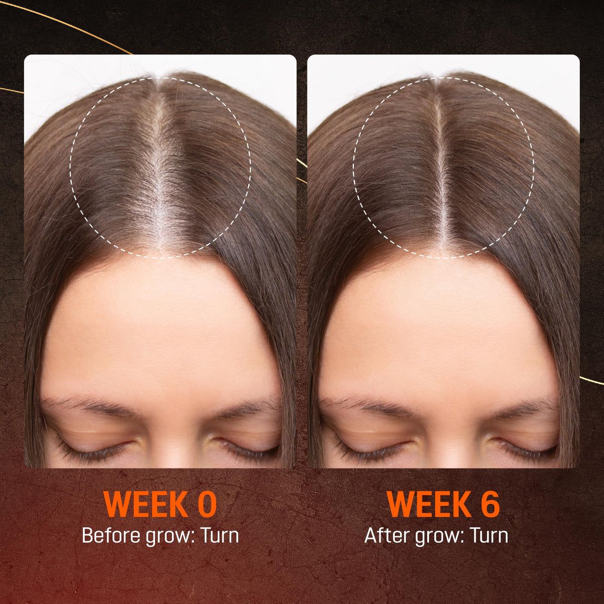 ABERA before-after results image illustrating visible thinning improvement