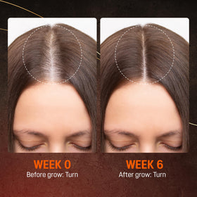 ABERA before-after results image illustrating visible thinning improvement
