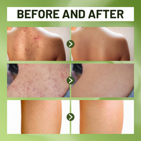 ABERA bottle pour shot illustrating easy daily cleansing for sensitive skin