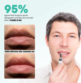 ABERA Fordyce Cream tube-pump view shows quick-absorb formula.