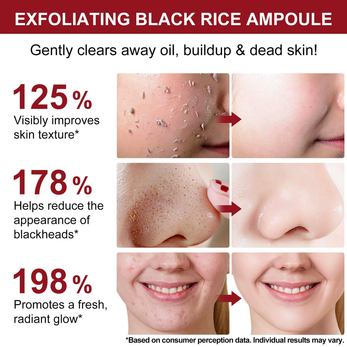 ABOUME Peel Shot niacinamide rice extract close-up for even skin tone support