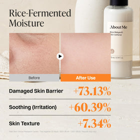 About Me Rice Makgeolli Skin Softener galactomyces ferment filtrate close-up suggests brighter complexion