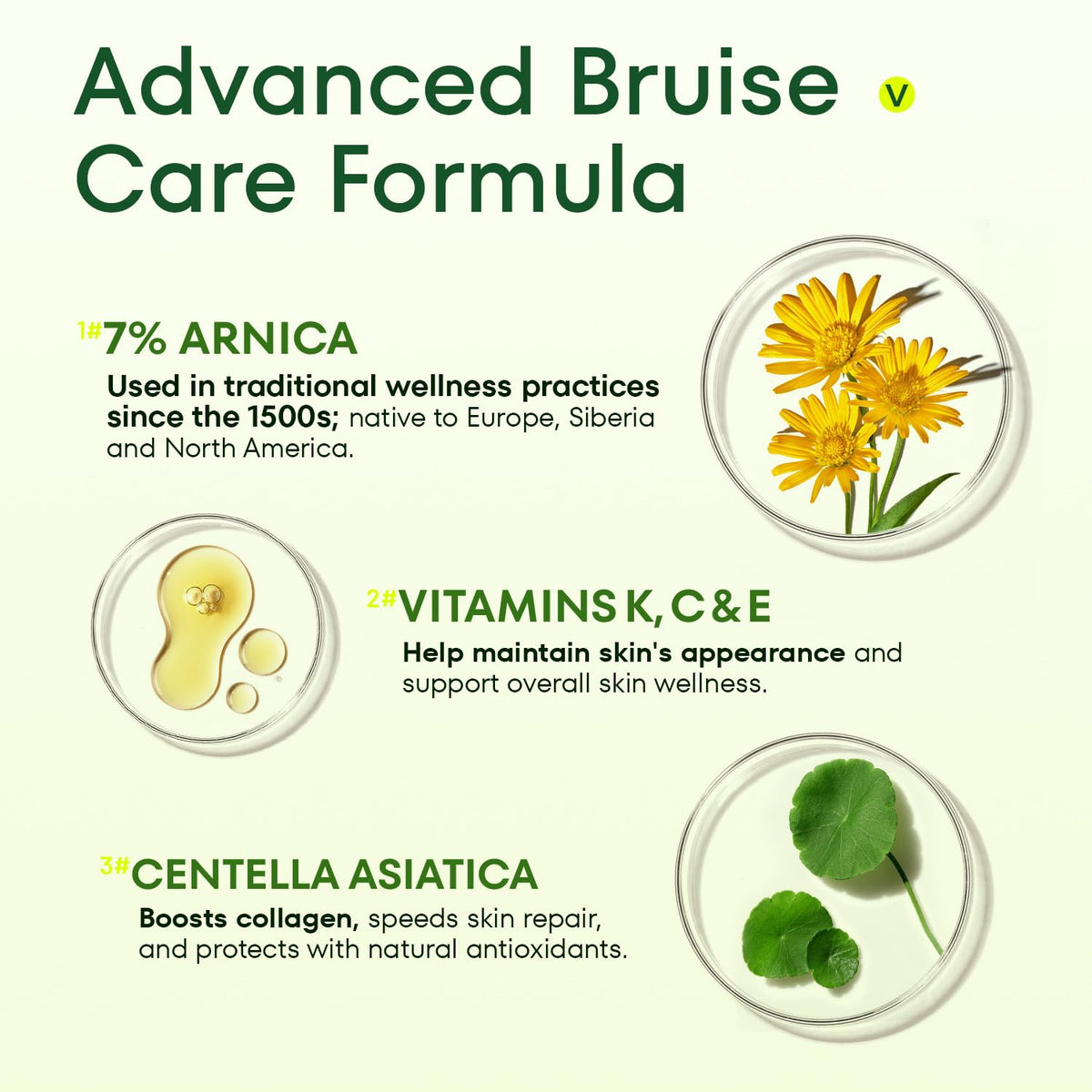 Acolye Arnica Cream on hands eases bruising and evens skin tone.