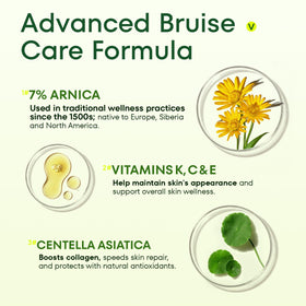 Acolye Arnica Cream on hands eases bruising and evens skin tone.
