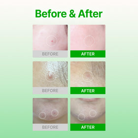 Two-step soothing system with tea tree oil and BHA cleanses pores.