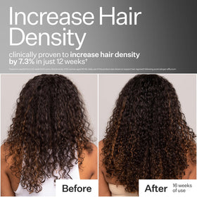 ACT+ ACRE stem cell peptide on scalp delivering 3% peptide for follicles