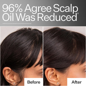 ACT+ ACRE fermented green tea astragalus ingredients highlighted for balanced sebum support.