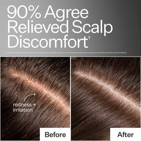 Act+Acre menthol cooling on scalp application.