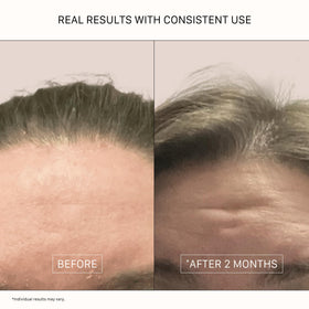 ACTIIV Remedy ingredients closeup highlighting antioxidant protection.