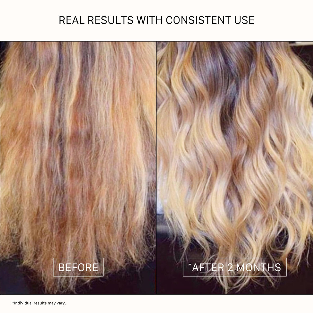 ACTIIV Renew scalp-health close-up showing balanced scalp and healthier roots.