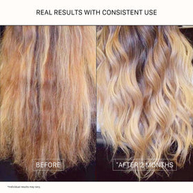 ACTIIV Renew scalp-health close-up showing balanced scalp and healthier roots.