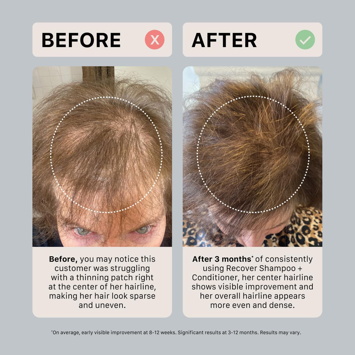 ACTIIV scalp massage action with shampoo for cleansing and scalp comfort
