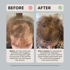 ACTIIV scalp massage action with shampoo for cleansing and scalp comfort