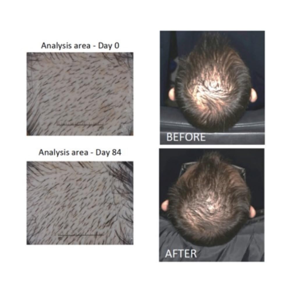 Close-up of scalp with density-focused Actsyl-3 action.