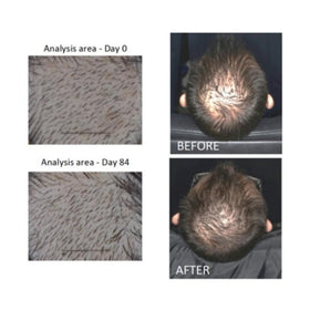 Close-up of scalp with density-focused Actsyl-3 action.
