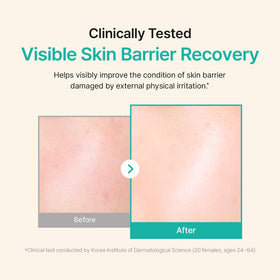 ACWELL Licorice pH Balancing Cream texture suitable for sensitive skin types