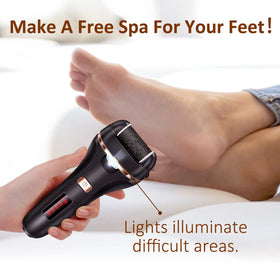 AdamPark demonstration of cracked heel removal at home