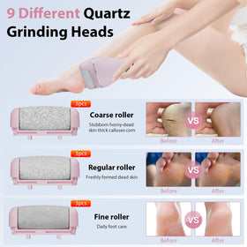 AdamPark Callus Remover LCD display shows speed and power status.
