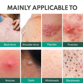 Adellina back-skin application demonstrates reaching hard-to-access areas.