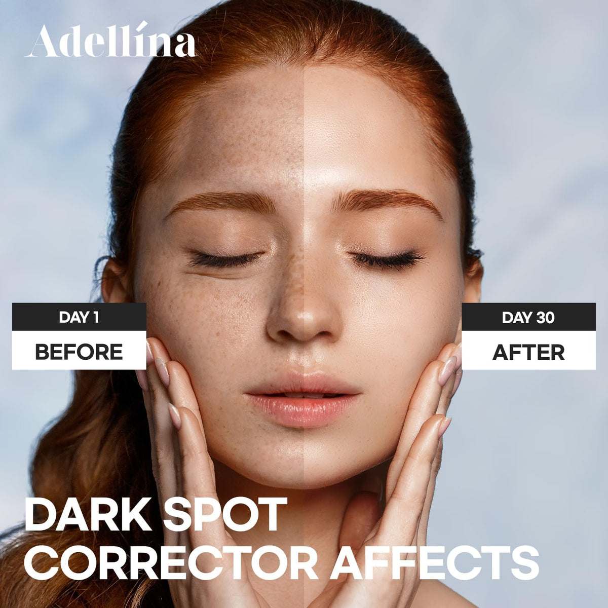Adellina skin texture close-up highlights smoother, more even-toned complexion.