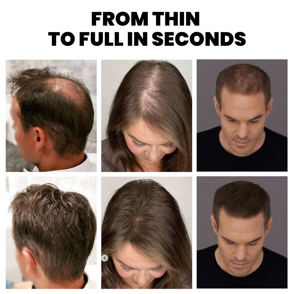 Adglamful Daily Use Hair Thickening Kit: versatile for work or events.