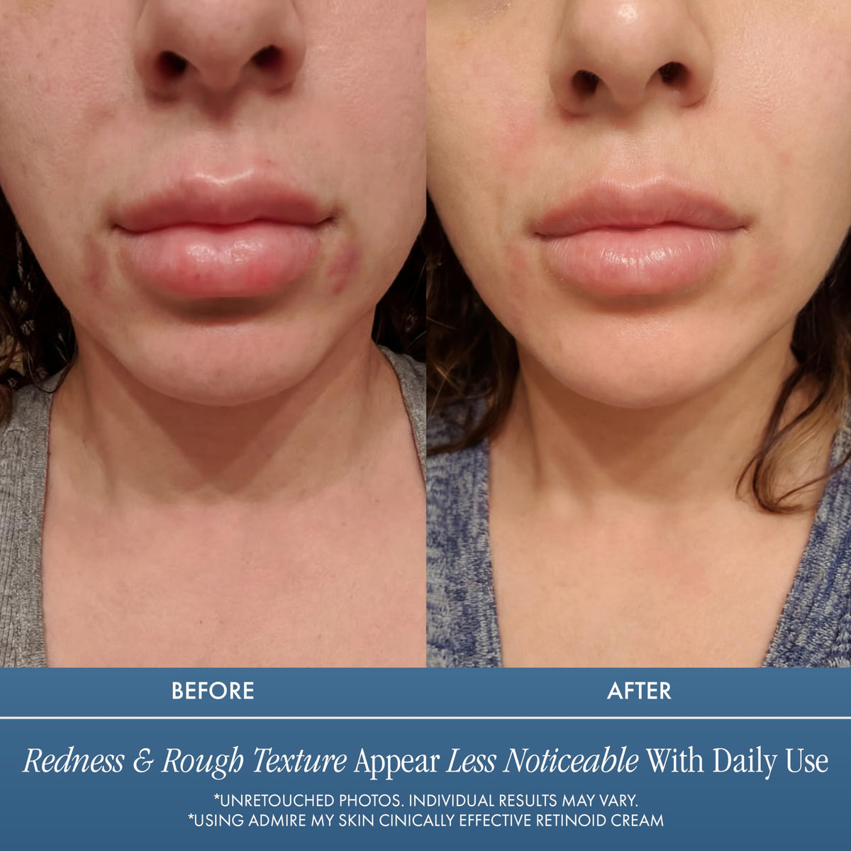 Admire My Skin Potent Retinoid Cream closeup shows creamy texture for smooth skin.