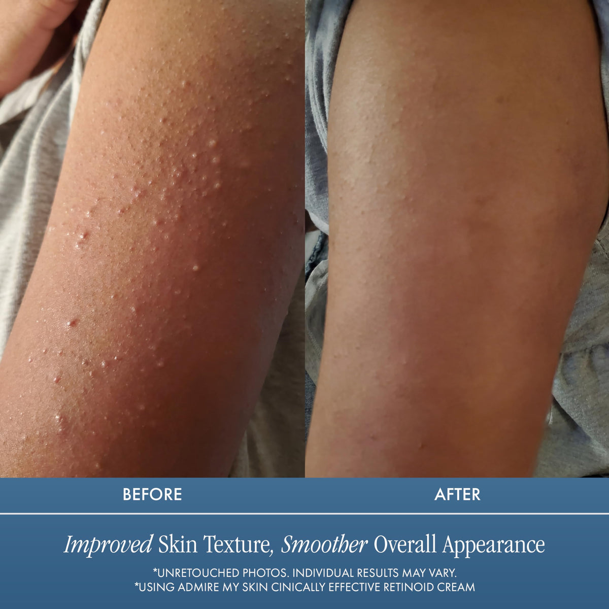 Admire My Skin Potent Retinoid Cream jar closeup highlights luxe packaging.