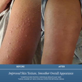 Admire My Skin Potent Retinoid Cream jar closeup highlights luxe packaging.