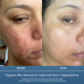 Admire My Skin Retinoid Cream pump dispenses for precise nightly application.