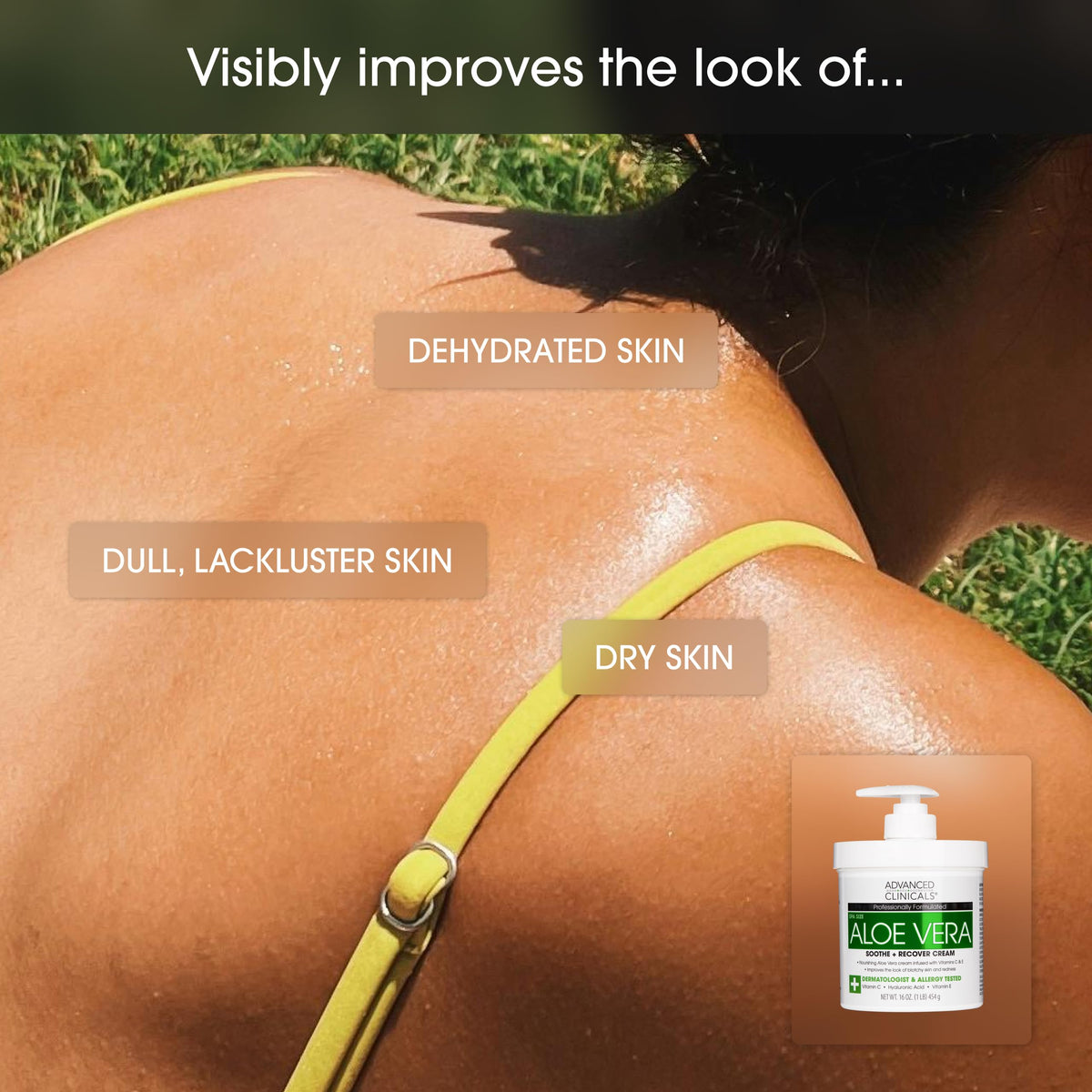 Advanced Clinicals Aloe Vera Lotion packaging and jar reflect a dermatologist-tested formula.