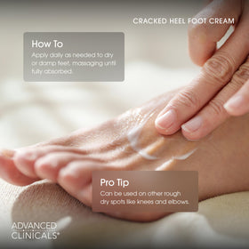 Advanced Clinicals cracked heel cream avocado oil helps soften calluses