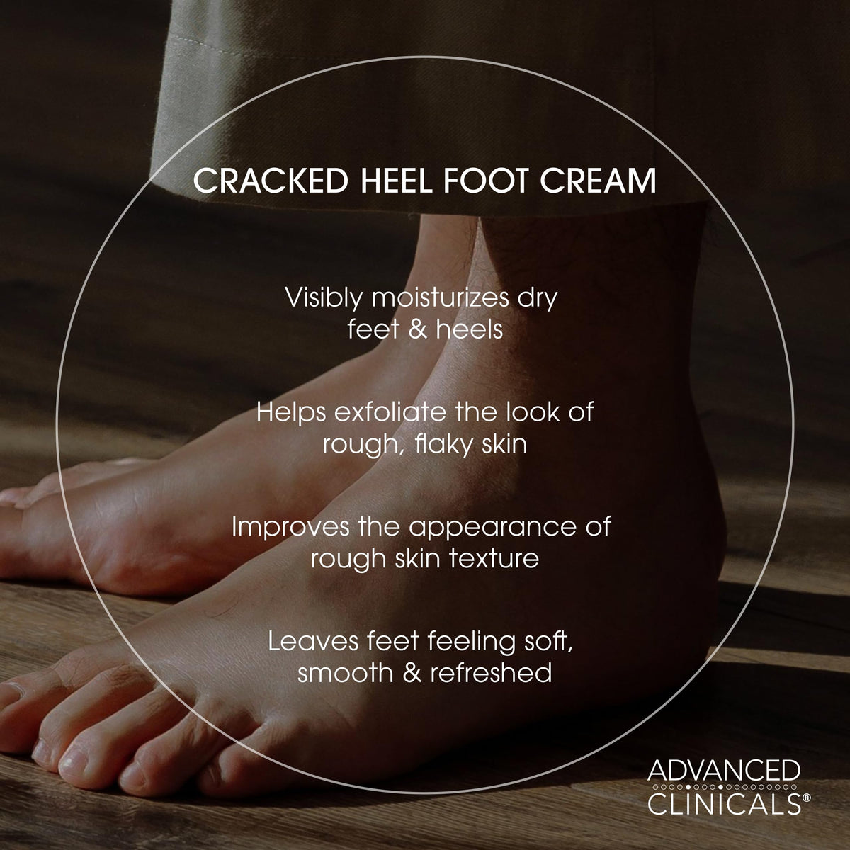 Advanced Clinicals cracked heel cream heel closeup shows creamy hydration