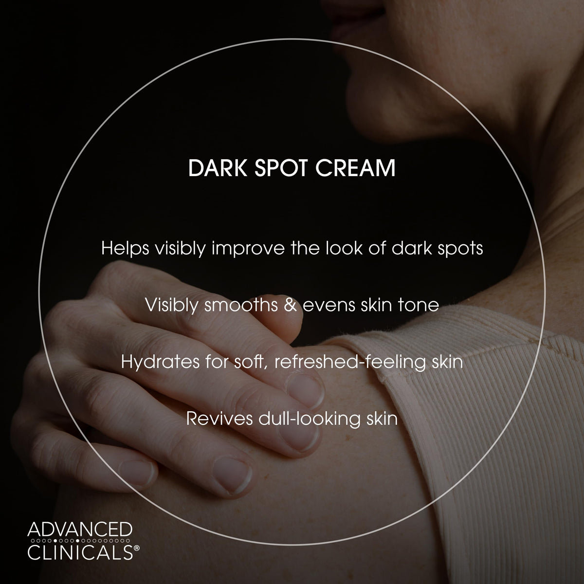 Advanced Clinicals Dark Spot Cream applied to the hand for daily body care.