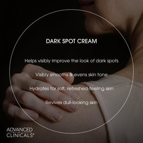 Advanced Clinicals Dark Spot Cream applied to the hand for daily body care.