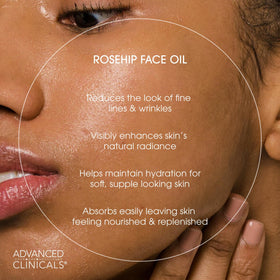 Advanced Clinicals Rosehip Oil bottle and applicator shown for easy use.