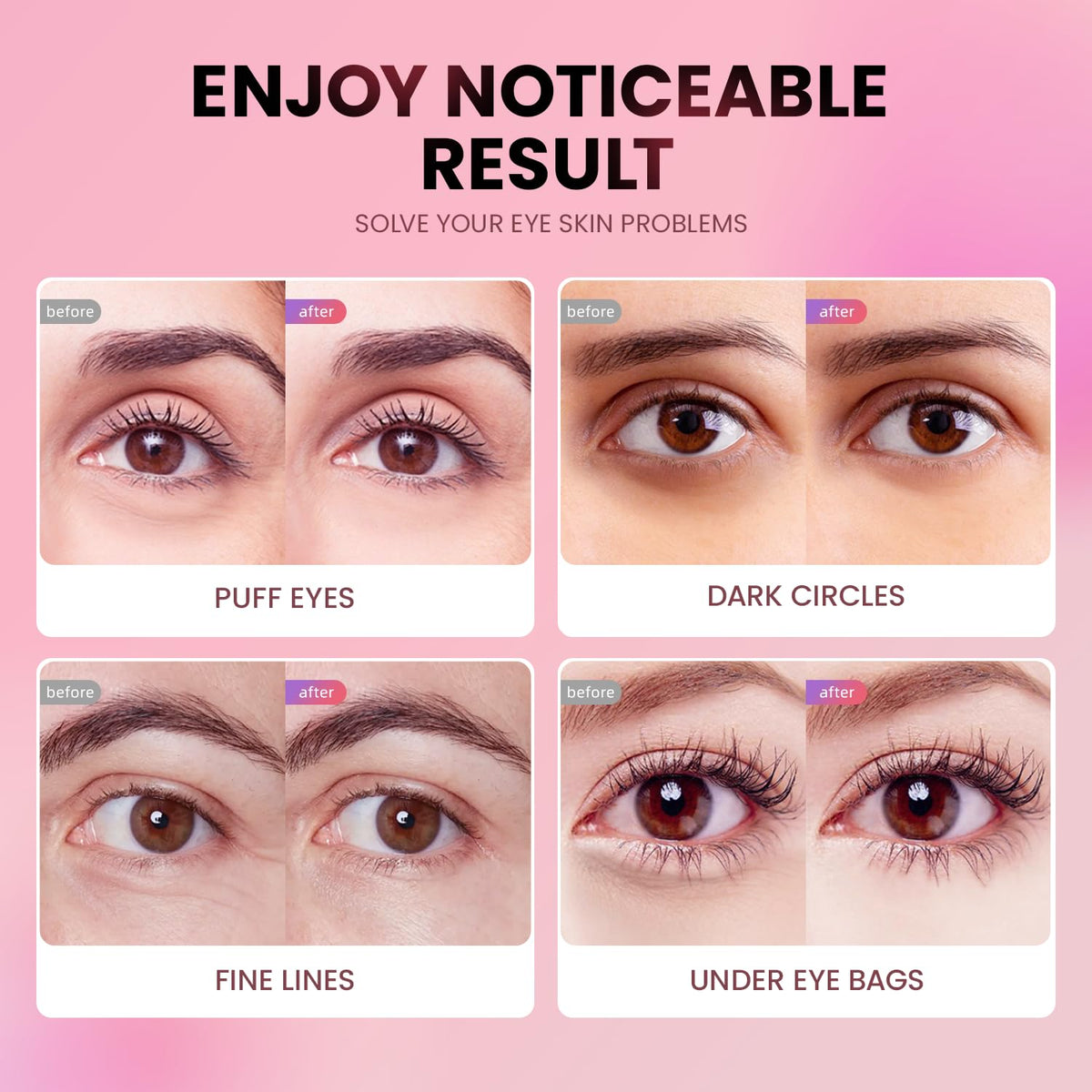 AILEORY eye patches soothe puffiness and brighten delicate under-eye skin