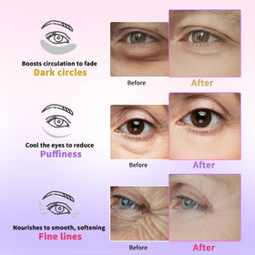 AILEORY hydrolyzed collagen and hyaluronic eye patches hydrate and smooth