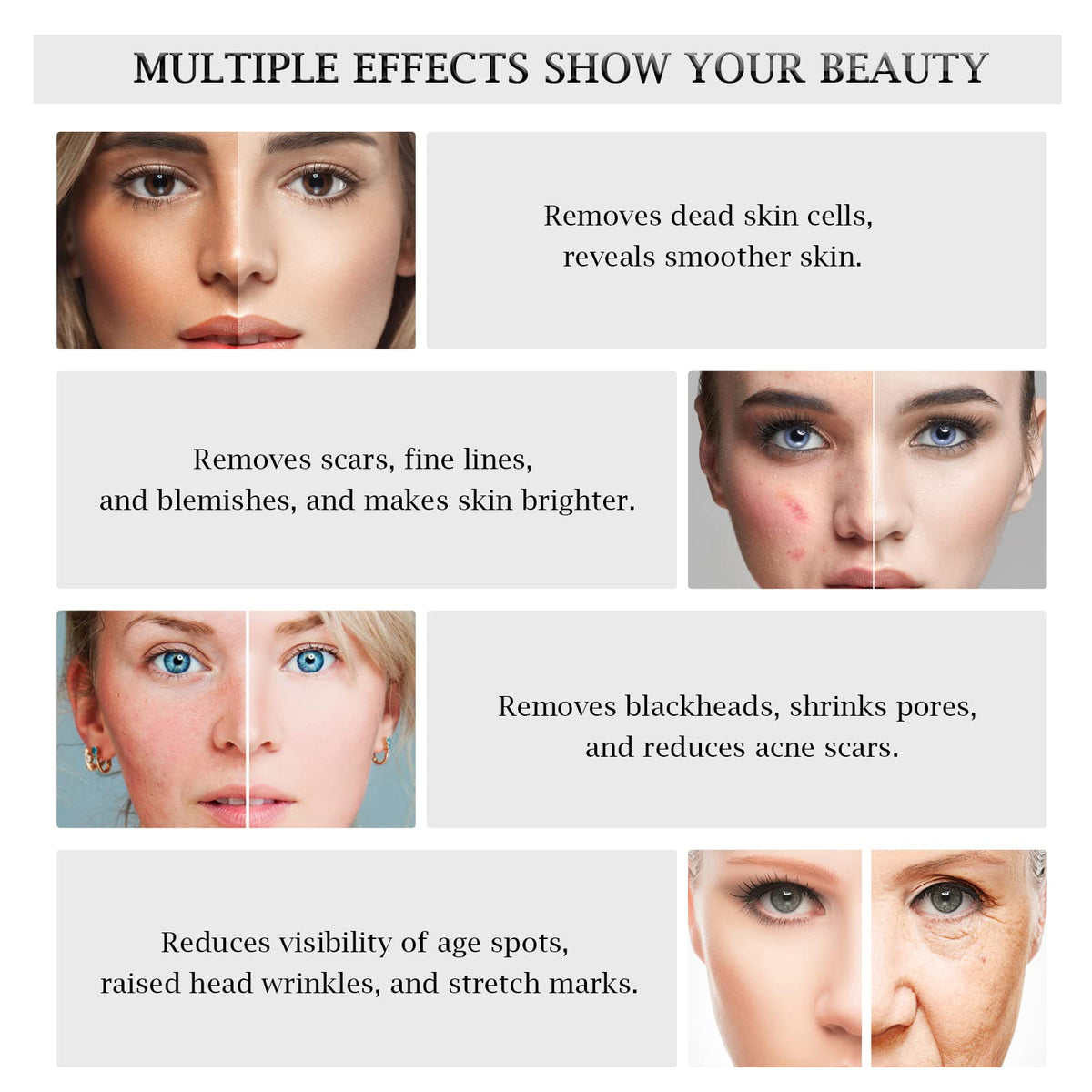 AIMENGXI professional-grade skin care device designed for salon and home use