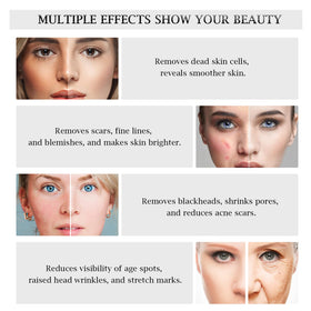 AIMENGXI professional-grade skin care device designed for salon and home use
