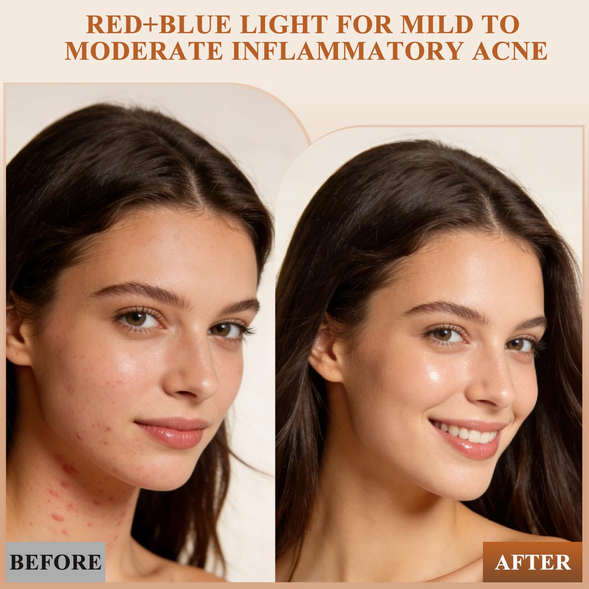 Aimilove cordless LED mask enabling treatment anywhere with rechargeable power