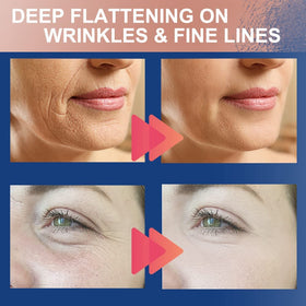 Akissos cosmetic patch kit supports quick skincare routines.