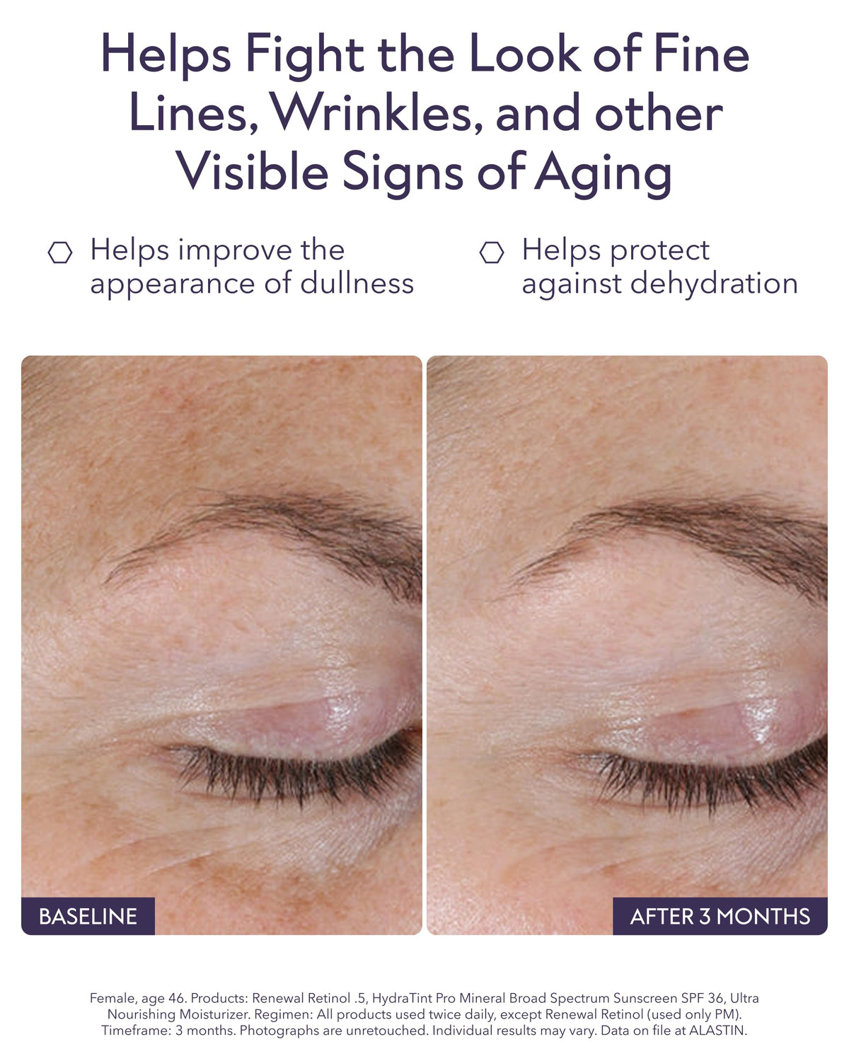 ALASTIN Renewal Retinol Serum dropper applies a gentle, hydrating retinol treatment.