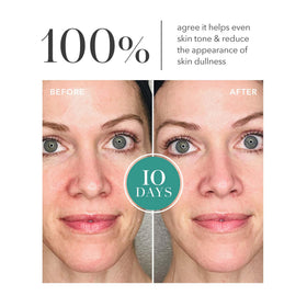Application scene showing Algenist Genius Essence enhancing skin radiance after use.