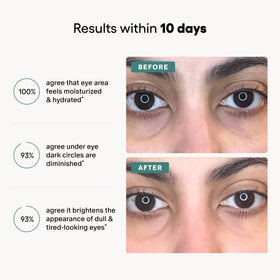 Algenist Vitamin E hydration supports nourished, moisturized eye skin.