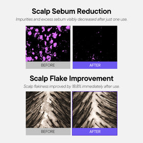 ALIVE:LAB ALIVELAB O2 Scalp Water formula close-up emphasizes sulfate-free care.