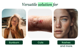 Allurials Aloe Vera Spray label close-up highlights purity and organic ingredients.