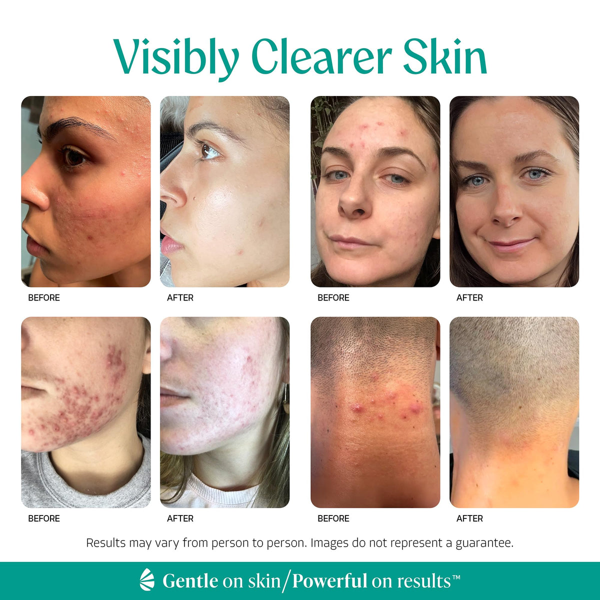Almond Clear serum texture droplet on skin during application