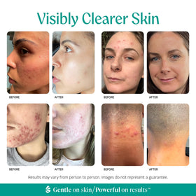Almond Clear serum texture droplet on skin during application