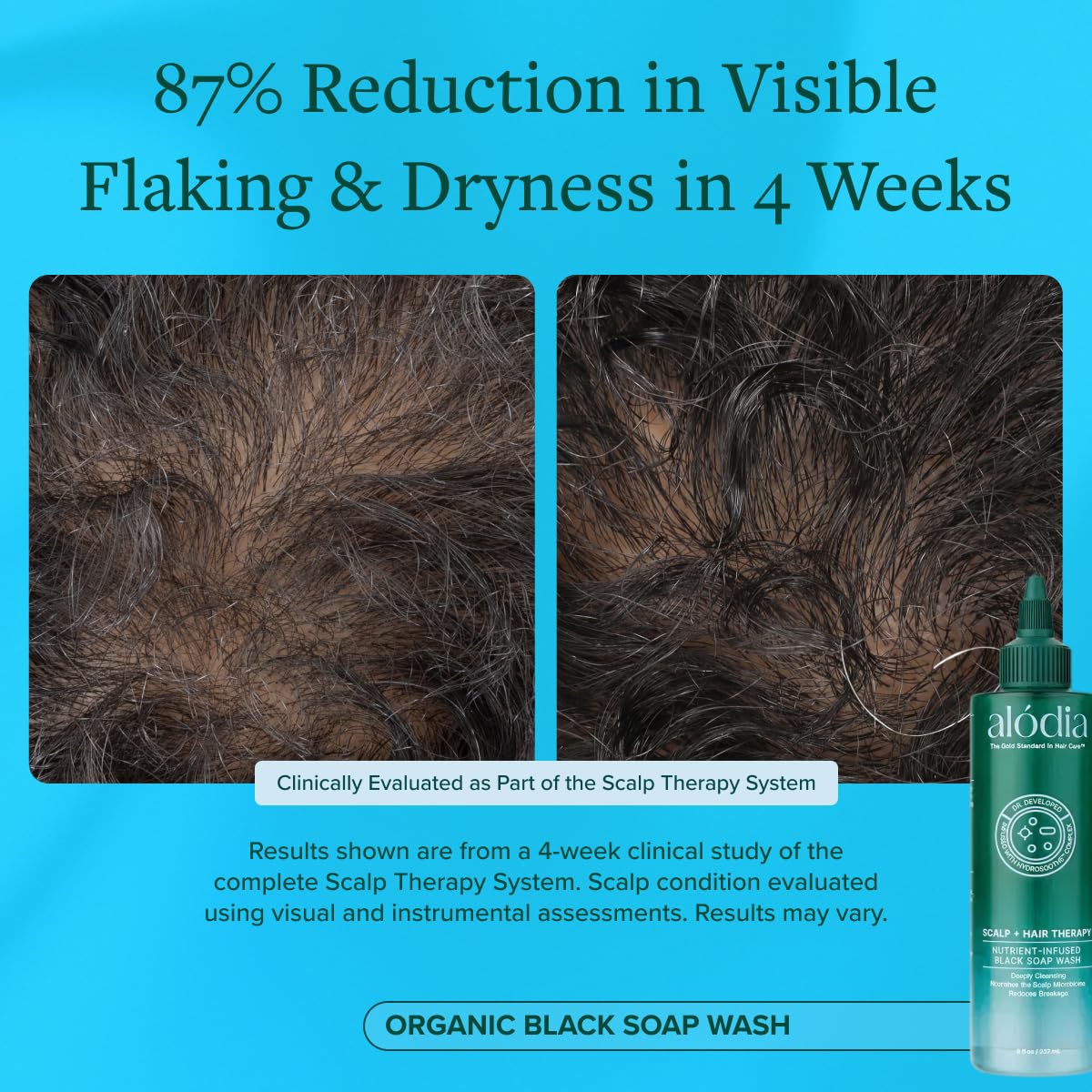 Product packaging of ALODIA Nutrient-Infused Black Soap Wash front view.